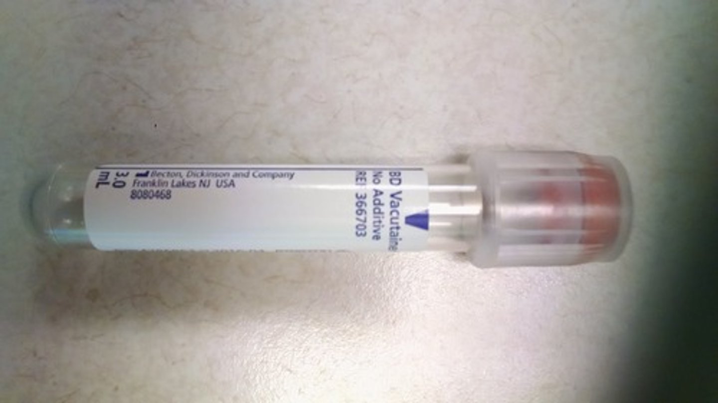 <p>discard tube</p><p>red glass may also be used in place of this</p>