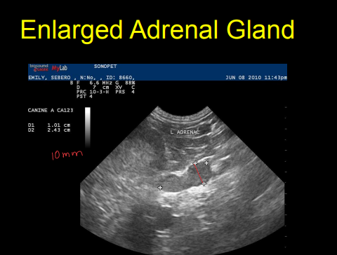 <p>Adrenal issues on Ultrasound</p>