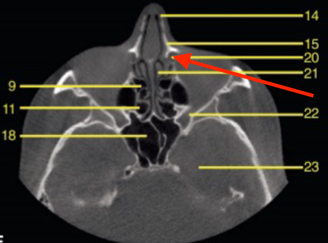 <p>identify the structure </p>