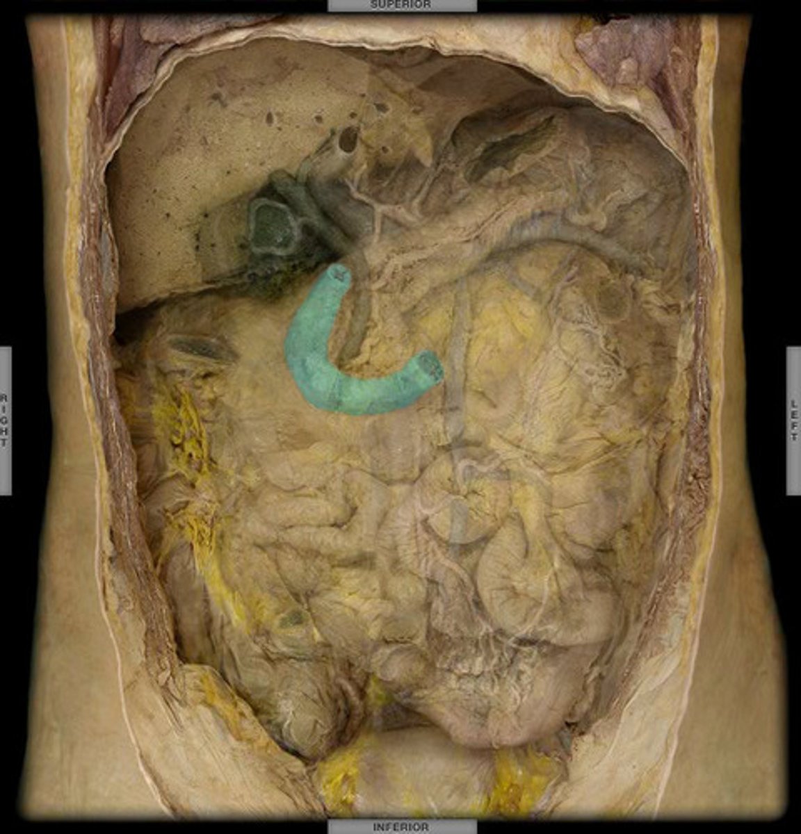 <p>First 10 to 12 inches of the small intestine</p>