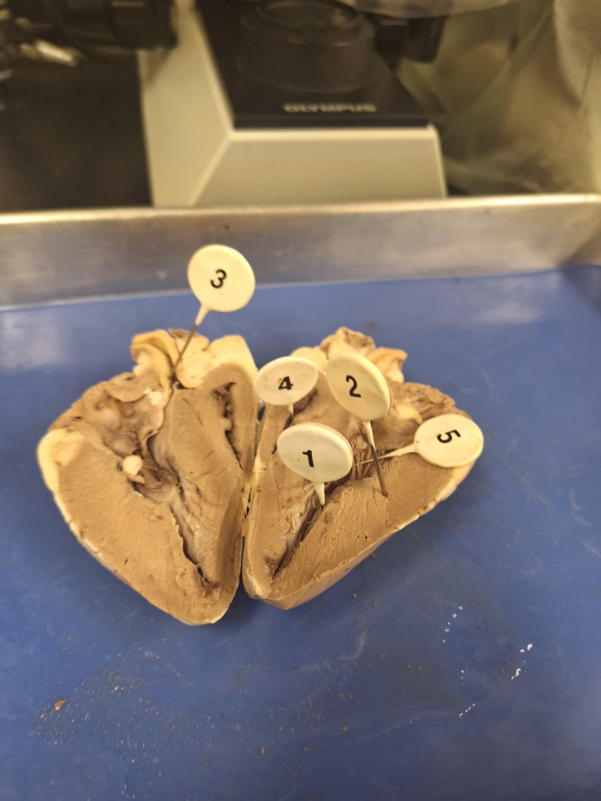 <p>What is the chamber to #4?</p>