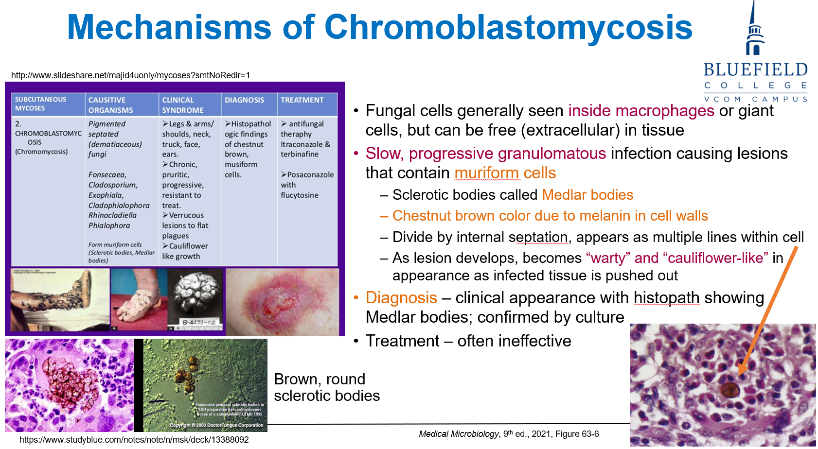 <p>C. Medlar body<br></p><p><strong>Medlar bodies</strong> are <strong>pigmented muriform cells</strong> seen in <strong>chromoblastomycosis</strong>.</p>