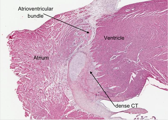 Atrioventricular septum
