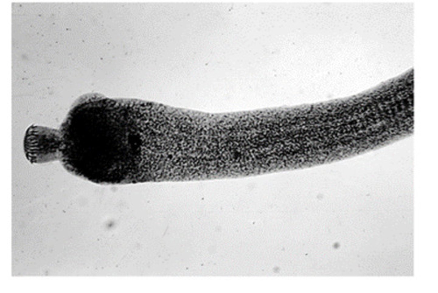 <p>Hymenolepis nana adult tapeworms have a scolex that is armed. This means the scolex contains __ at the top</p>