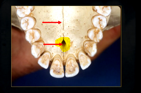 <p>what is this large hole?</p>