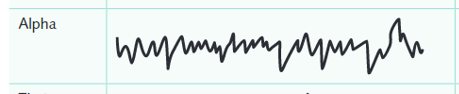<ul><li><p>Low–medium amplitude and medium–high frequency</p></li></ul><p></p>
