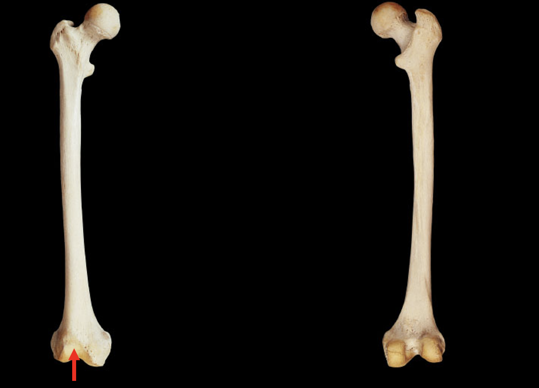 <p>Name this region of the femur</p>
