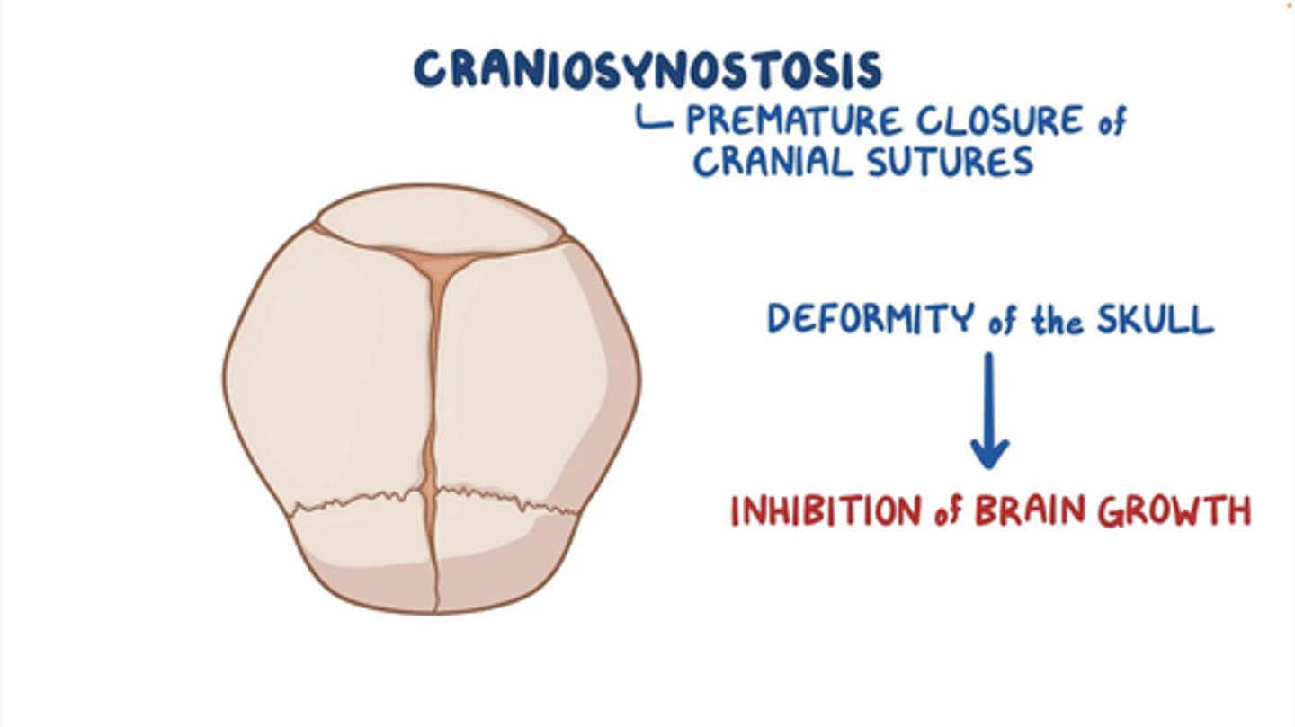 <p>Premature fusion of 1 or more cranial sutures, often resulting in an abnormal head shape</p>