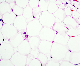 <p>• Fat cells which store lipid in cytoplasm</p><p>• Provide cushion, insulation and thermoregulation</p>