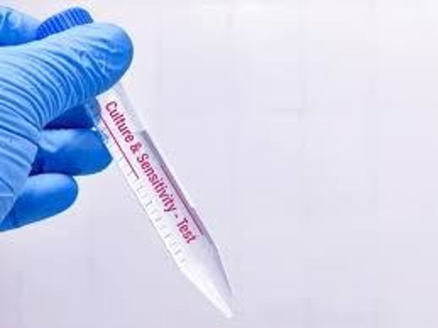 <p>Collect urine for testing culture and sensitivity.</p>