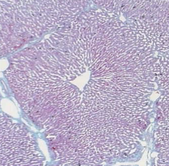 <p>What is shown in the image? What is the hole in the middle? what is the shape?</p>