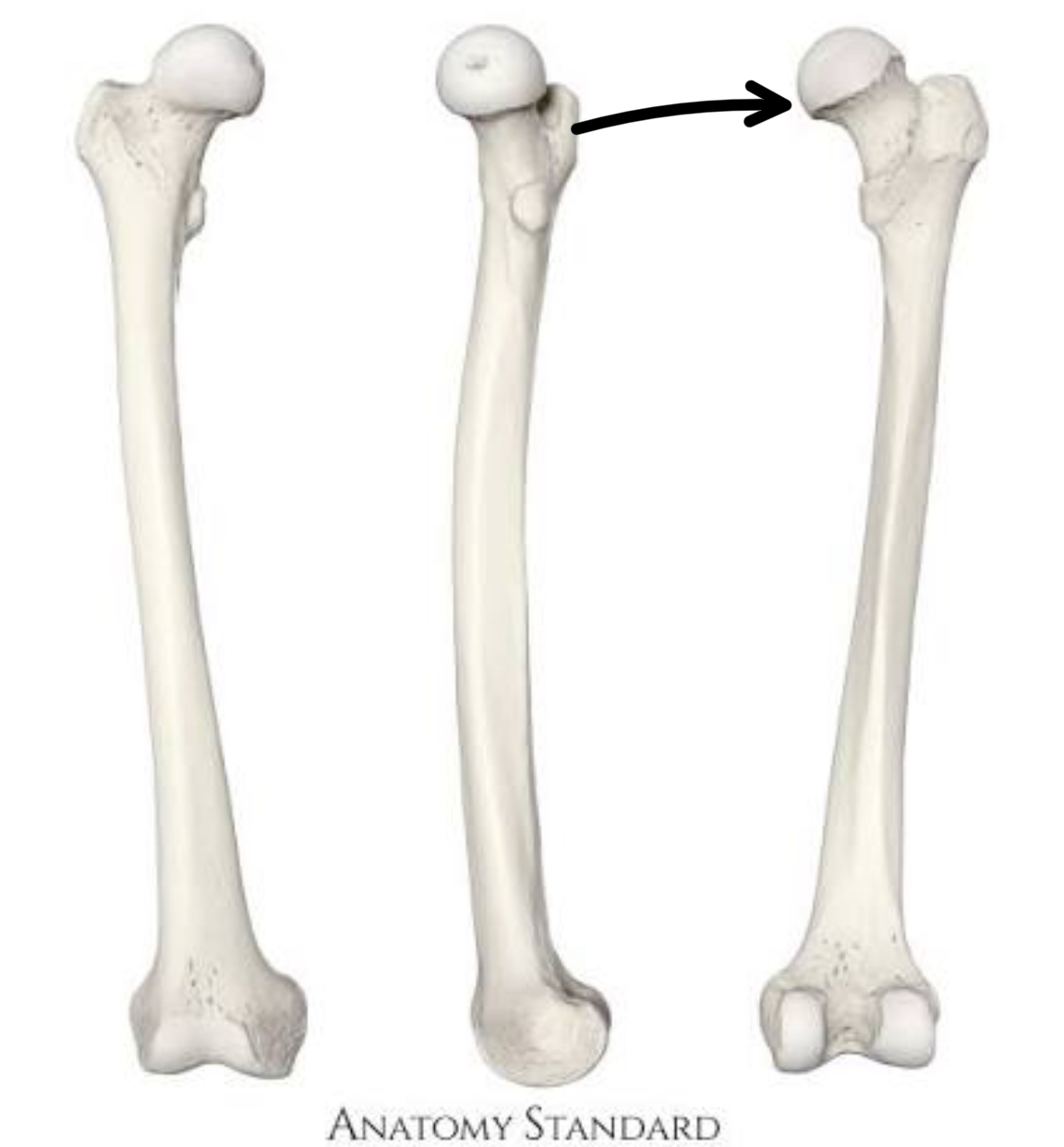 <p>what part of the femur is this?</p>
