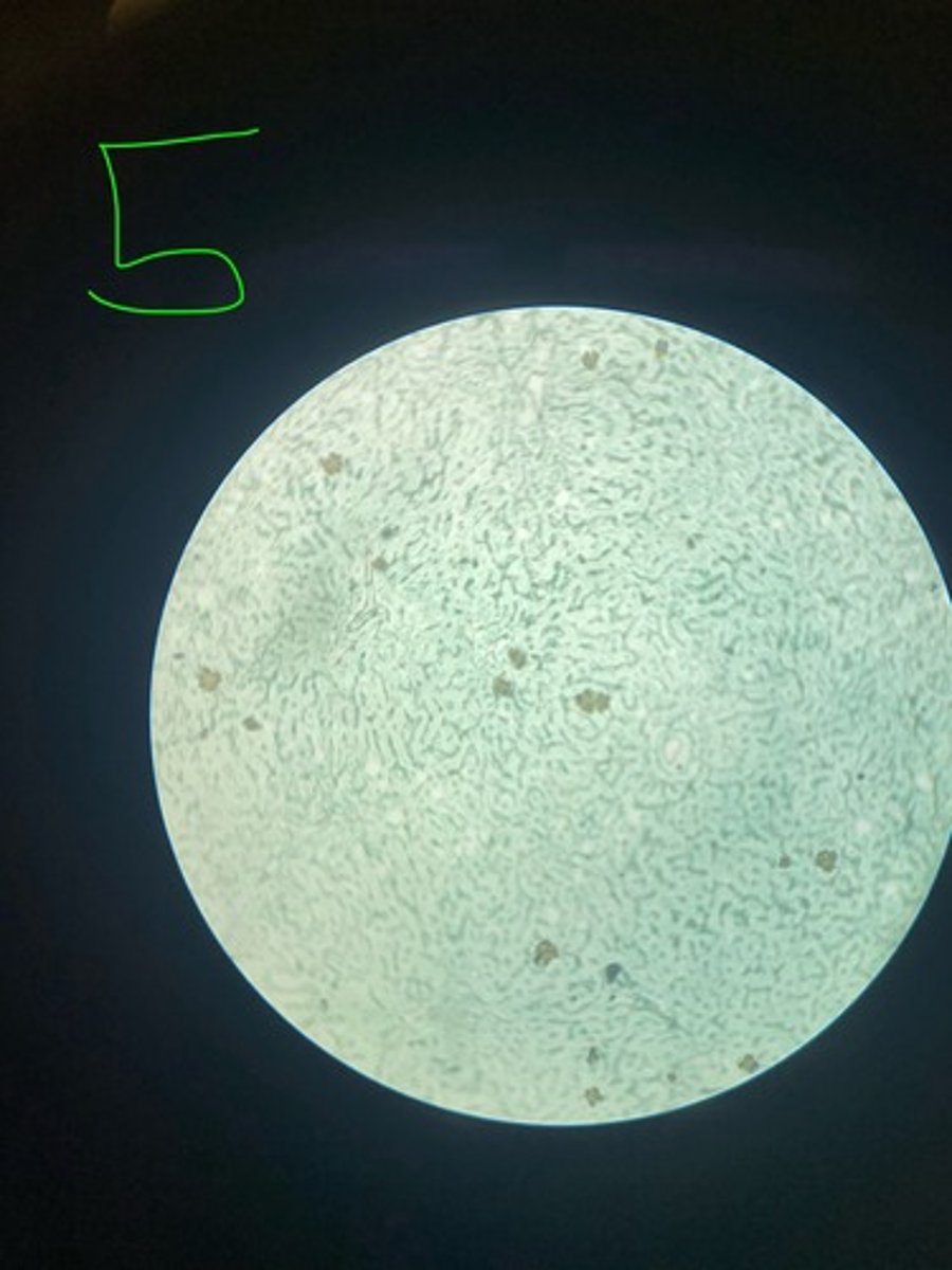 <p>What stain is this?</p>