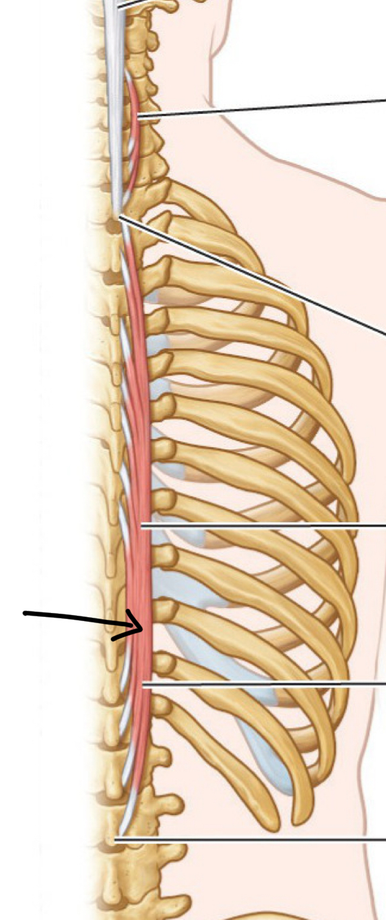 <p>What mm?</p><p>O, I, A bilateral and unilateral</p>
