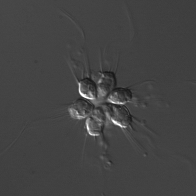 <p>Choanoflagellates </p>