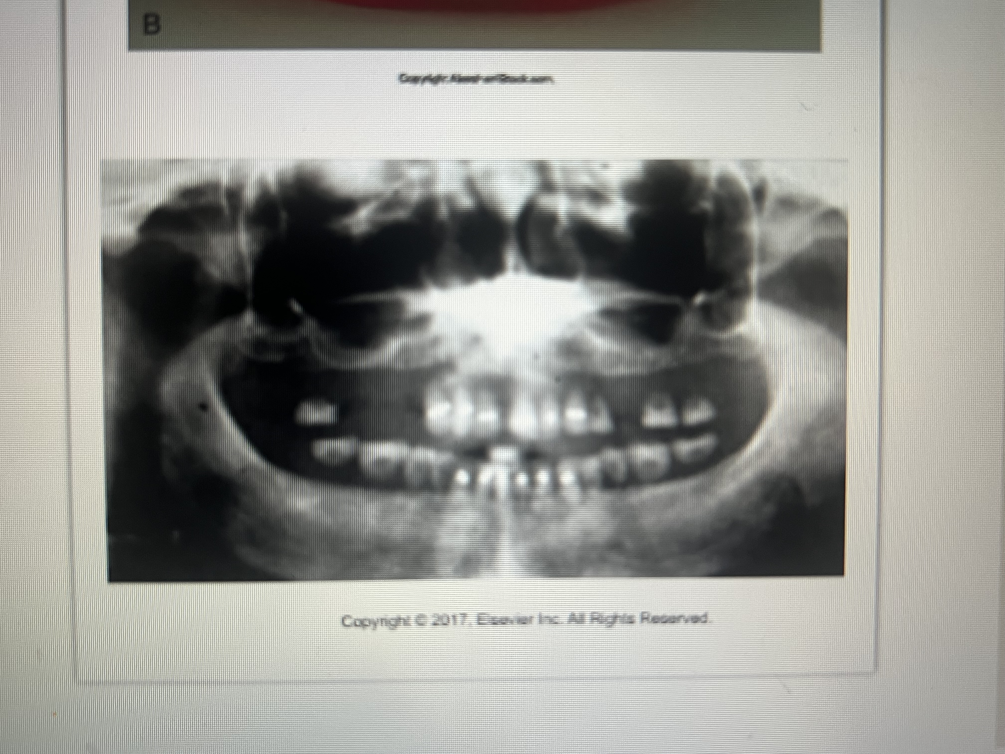 <p>Varies depending on the materials used</p>