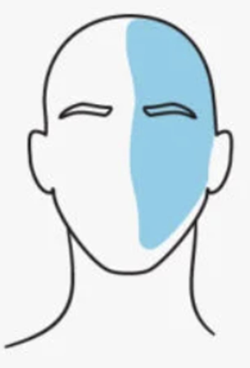 <p>the trigeminal nerve</p><p>- typically occurs on one side of the head</p>