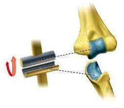 <p>flexion and extension; monaxial (a single axis)</p>