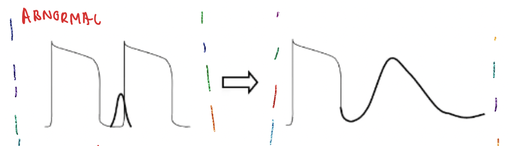 <p>Ca2+ blocker would depress/block the Ca2+ current ==&gt; block heart beat ==&gt; skip in next incoming action potential ==&gt; action potential returns normal</p><p></p><img src="https://knowt-user-attachments.s3.amazonaws.com/7df95101-23e9-411b-8b9a-ac48f2a4cff0.png" data-width="75%" data-align="center"><p></p>