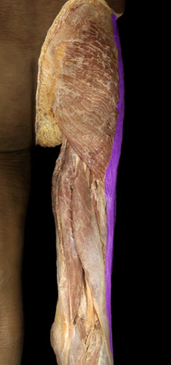 <p>IT band</p><p>sheet on lateral side</p><p>(hip/thigh)</p>