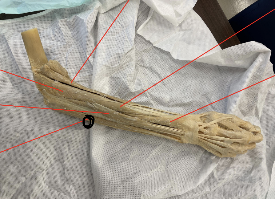 <p>identify + state origin, insertion, action, innervation of marked structure</p>