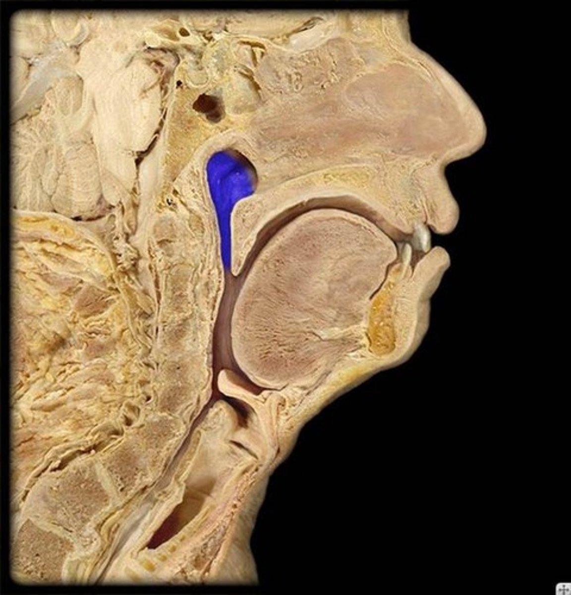 <p>Identify this specific region.</p>