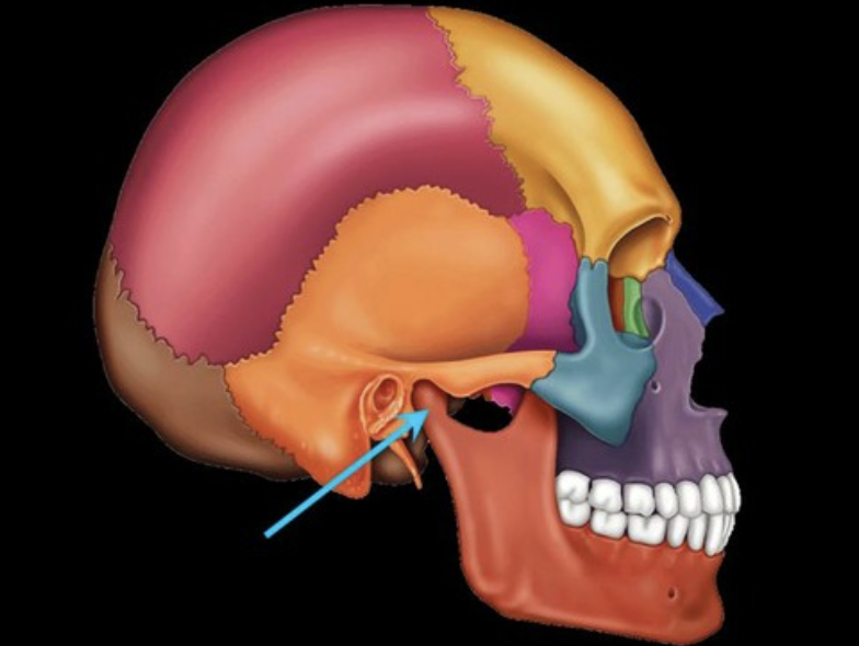 term image