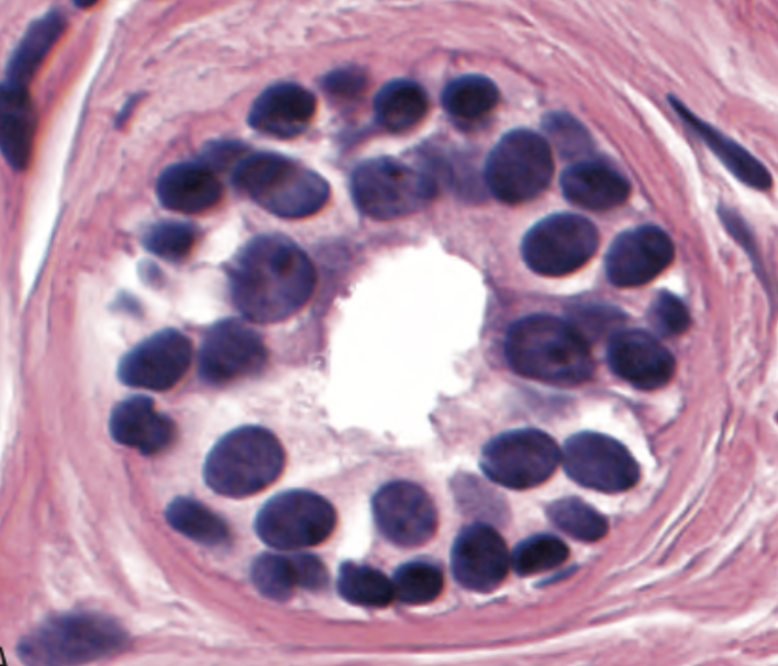 <p>diagnpostico </p>