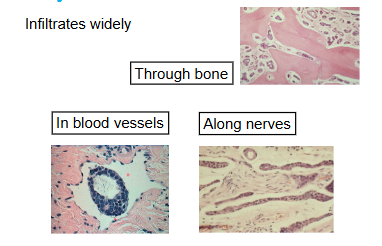 <p>Via blood stream and nerve invasion</p>