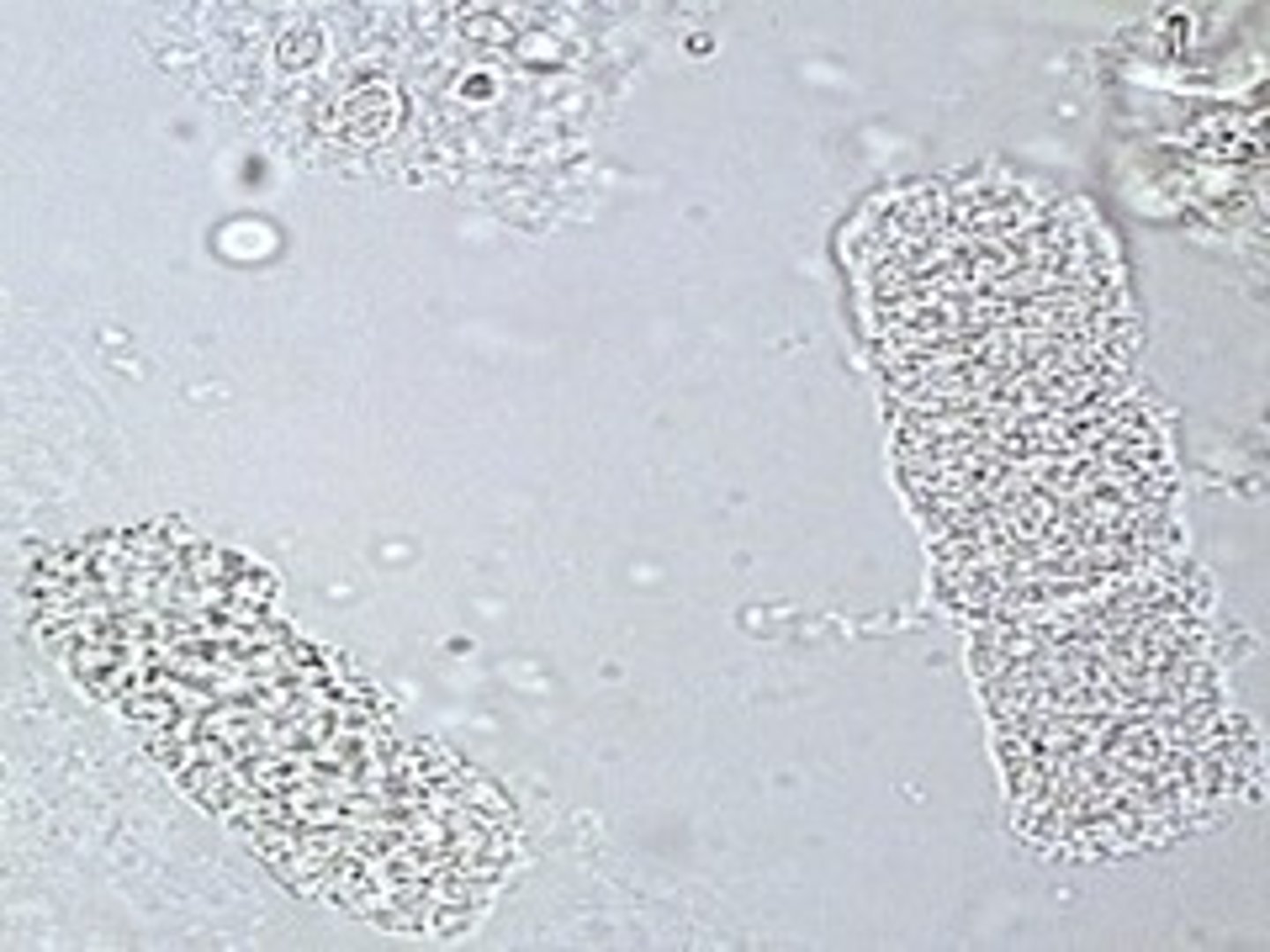 <p>grainy, most common</p>