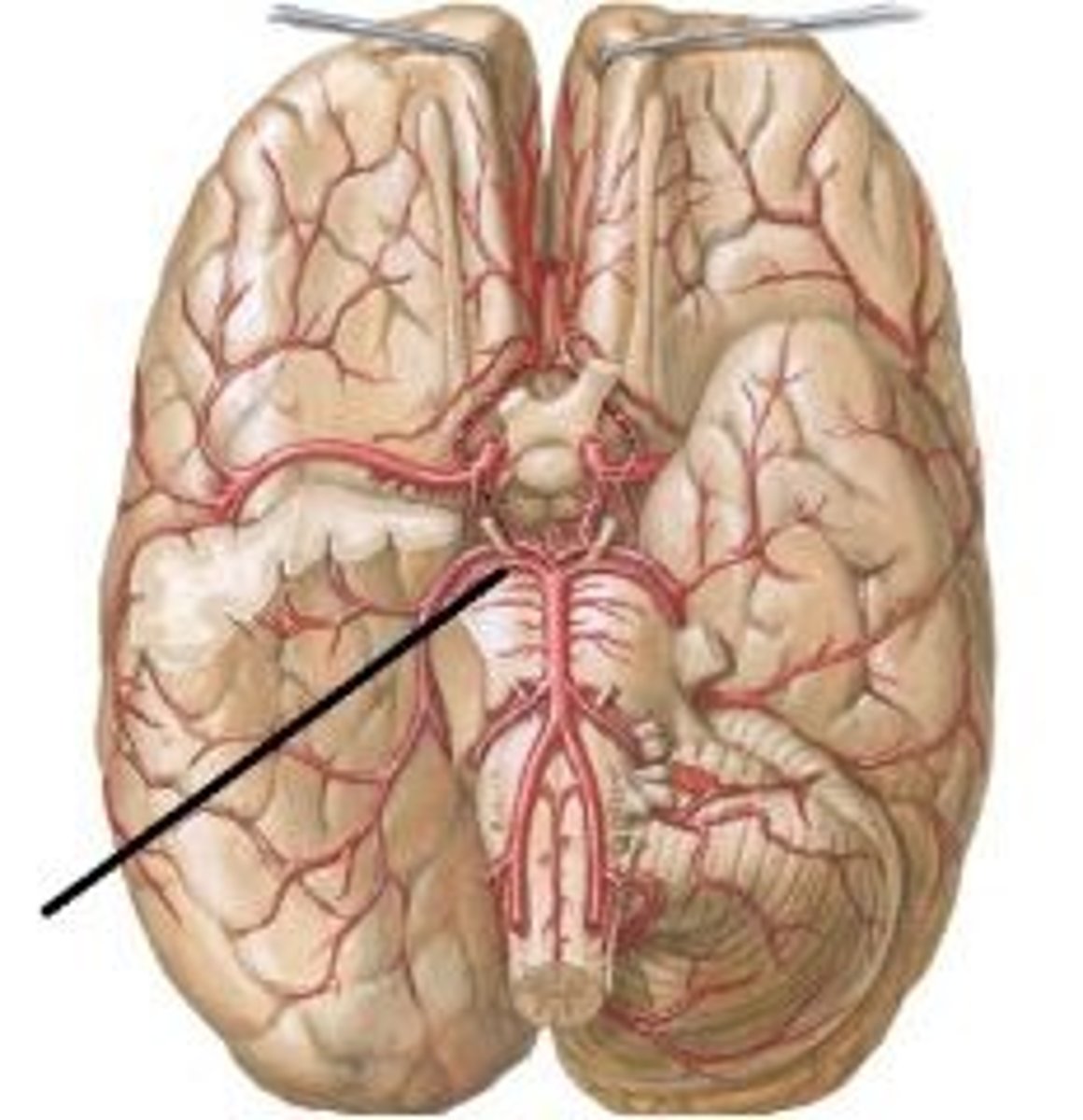 <p>from basilar; supplies superior cerebellum</p>