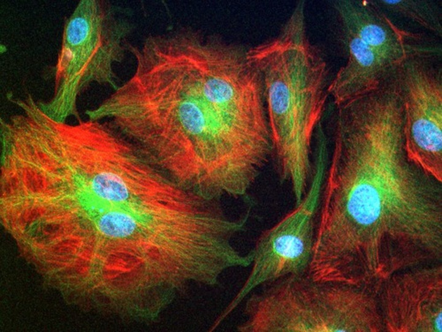 <p>Allows visualization of naturally fluorescent microorganisms or those stained by a fluorescent dye including labeled antigens and antibodies</p>