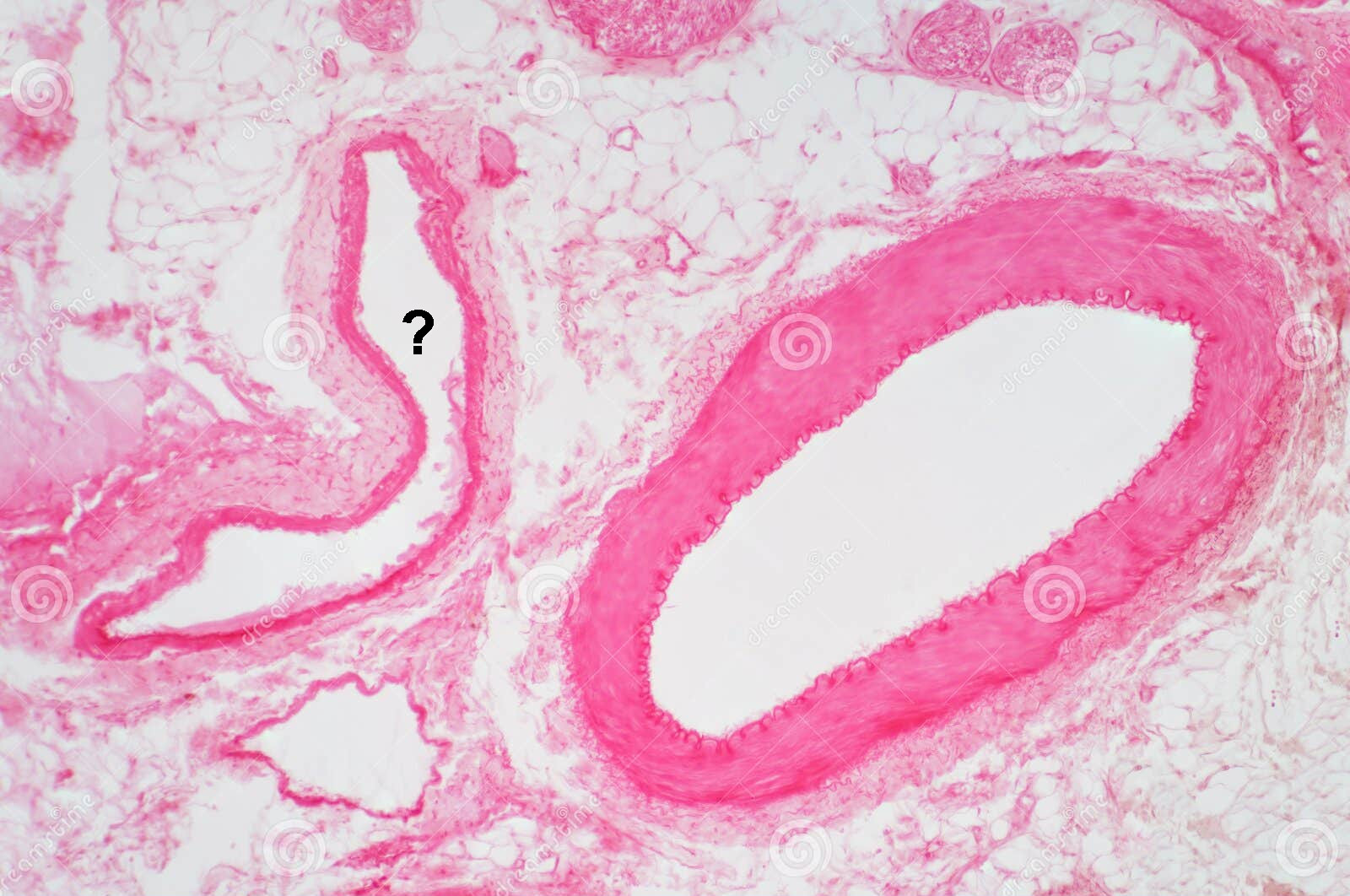 <p>Is this a vein or an artery?</p>