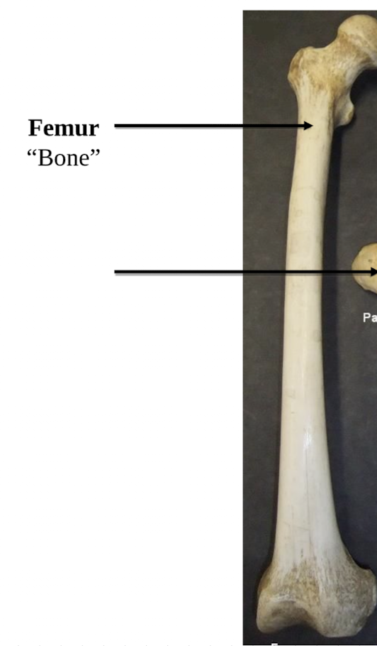 <p>Femur </p>