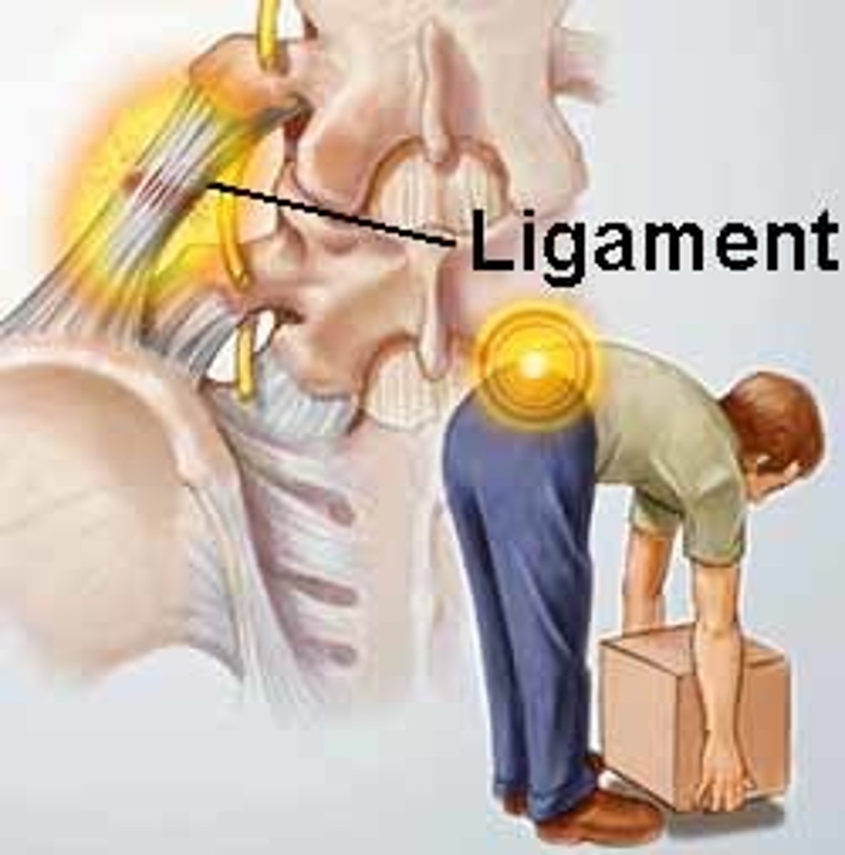 <p>What is a less serious injury, an overstretched or partially torn muscle?</p>