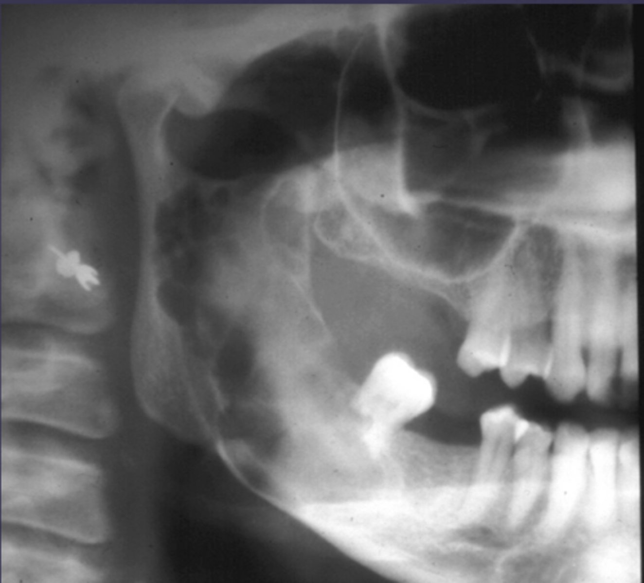 <p>How would you describe the lesion?</p>