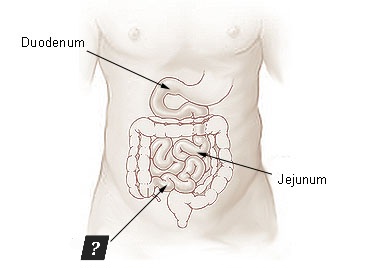 <p>Function?</p>
