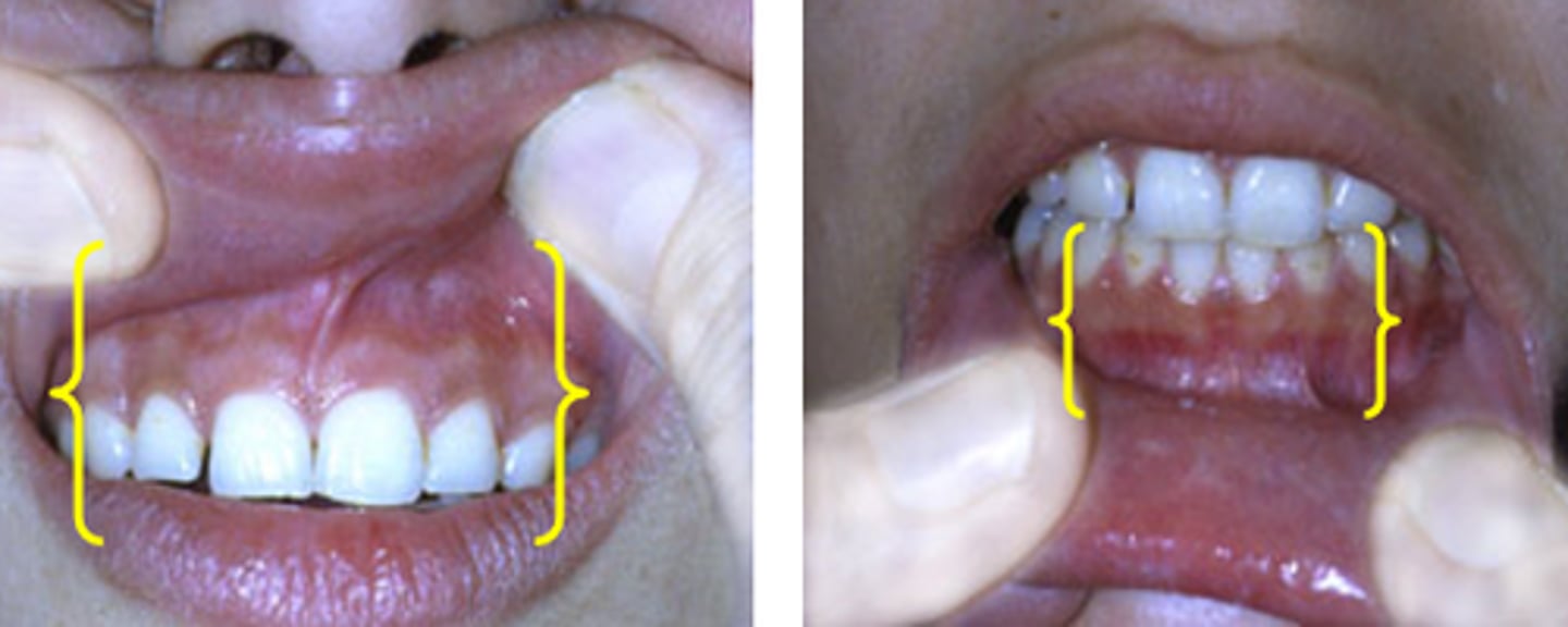 <p>between the teeth and lips</p>