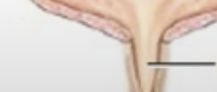 <p><span style="background-color: transparent;">lowest part of urinary tract through which urine passes from the urinary bladder to outside </span></p>