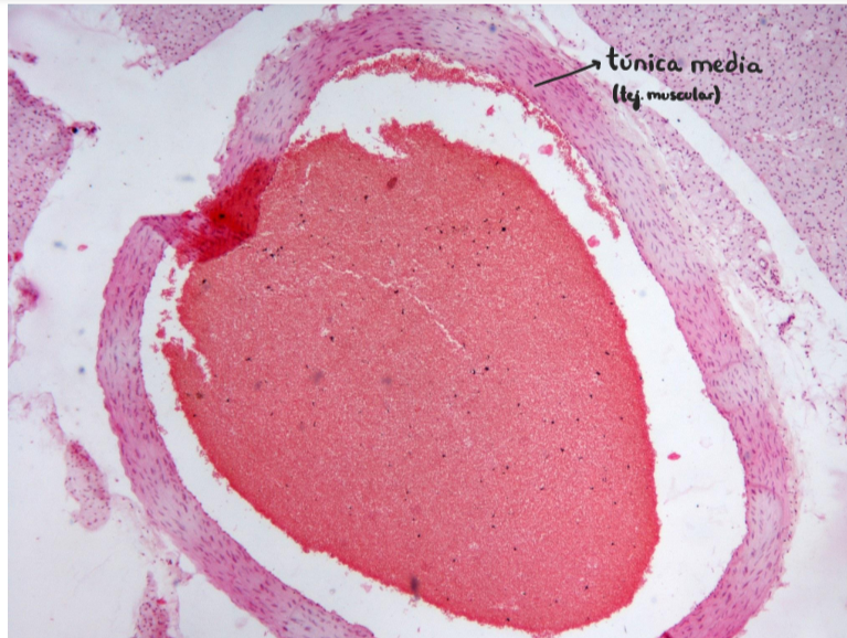 <p>Arteria pulmonar (muscular)</p><p>la arteria más pequeña</p>