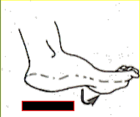 <p>What Movement is occurring?</p>