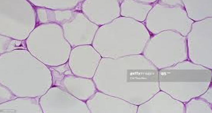 <p>A type of connective tissue that stores fat, providing insulation and energy storage. It is located beneath the skin in breasts</p>