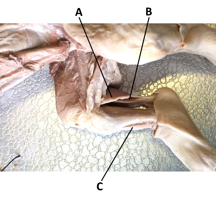 <p><span><span>Identify the muscle labeled with the letter A.</span></span></p>