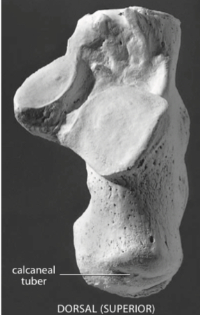 <p>Heel bone. The largest of the tarsal bones.</p>