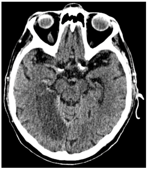 <p>What does this CT image show?</p>