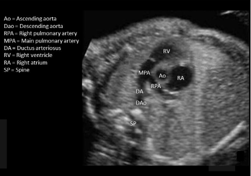 <p>the most anterior spot on the picture</p>