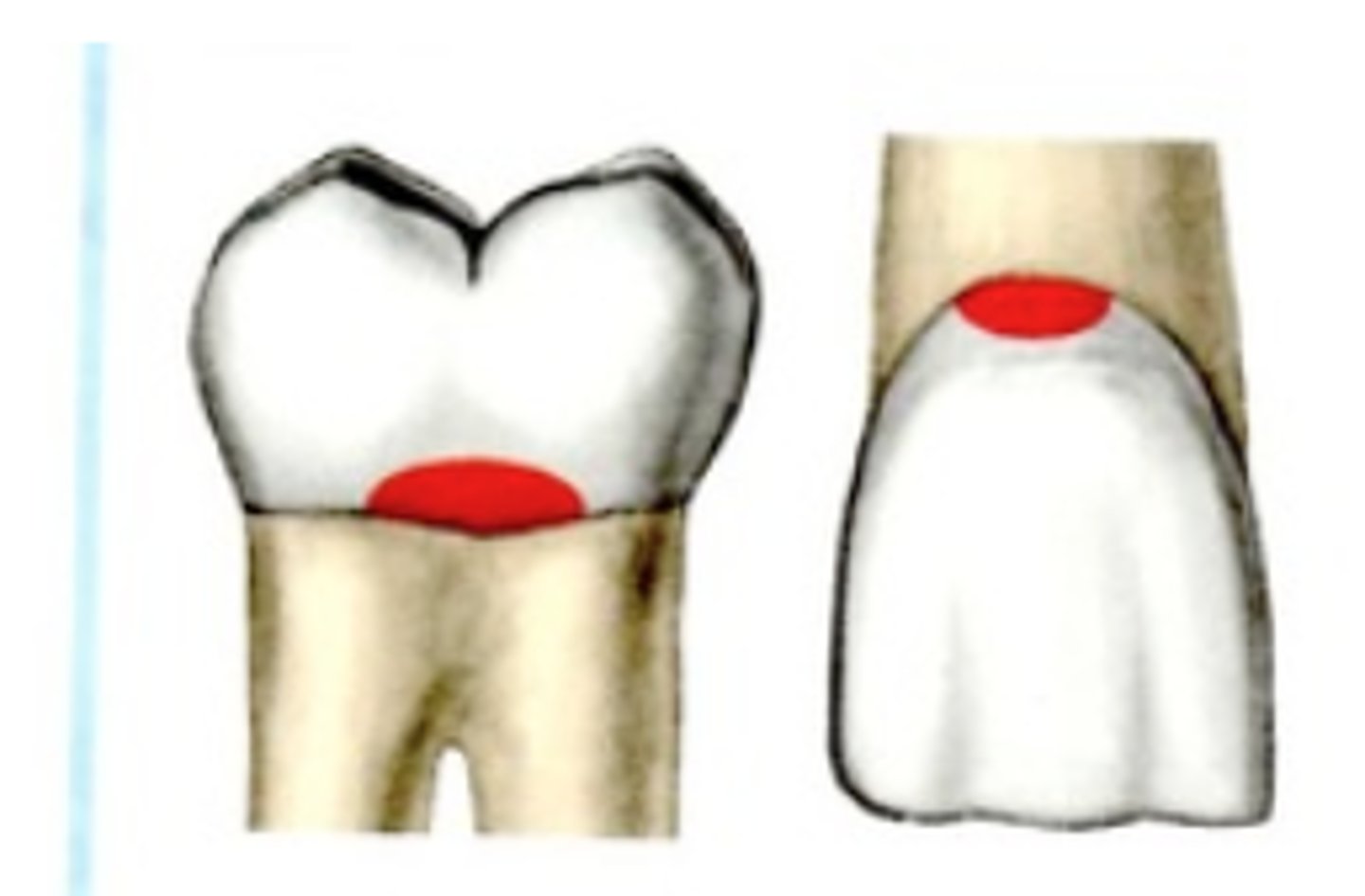 <p>cervical 1/3 of facial or lingual</p>
