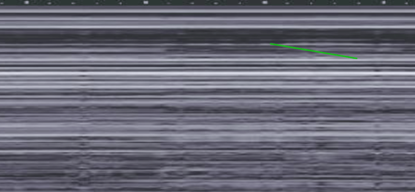 <p>what is this and what is it indicative of</p>