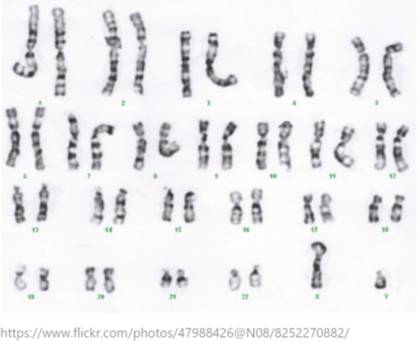 <p>karyotyping</p>