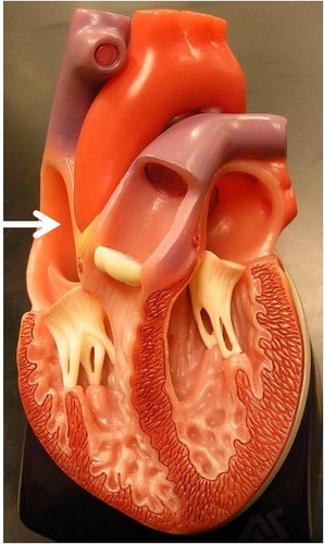 Receives deoxygenated blood from the body